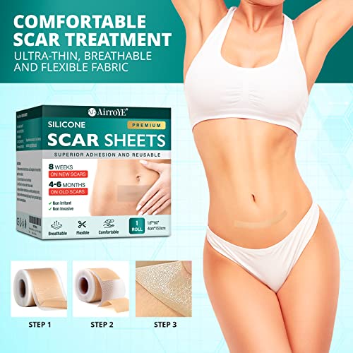 Silicone Scar Sheets, 1.6"x 120" Roll F55941
