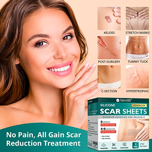 Silicone Scar Sheets, 1.6"x 120" Roll F55941