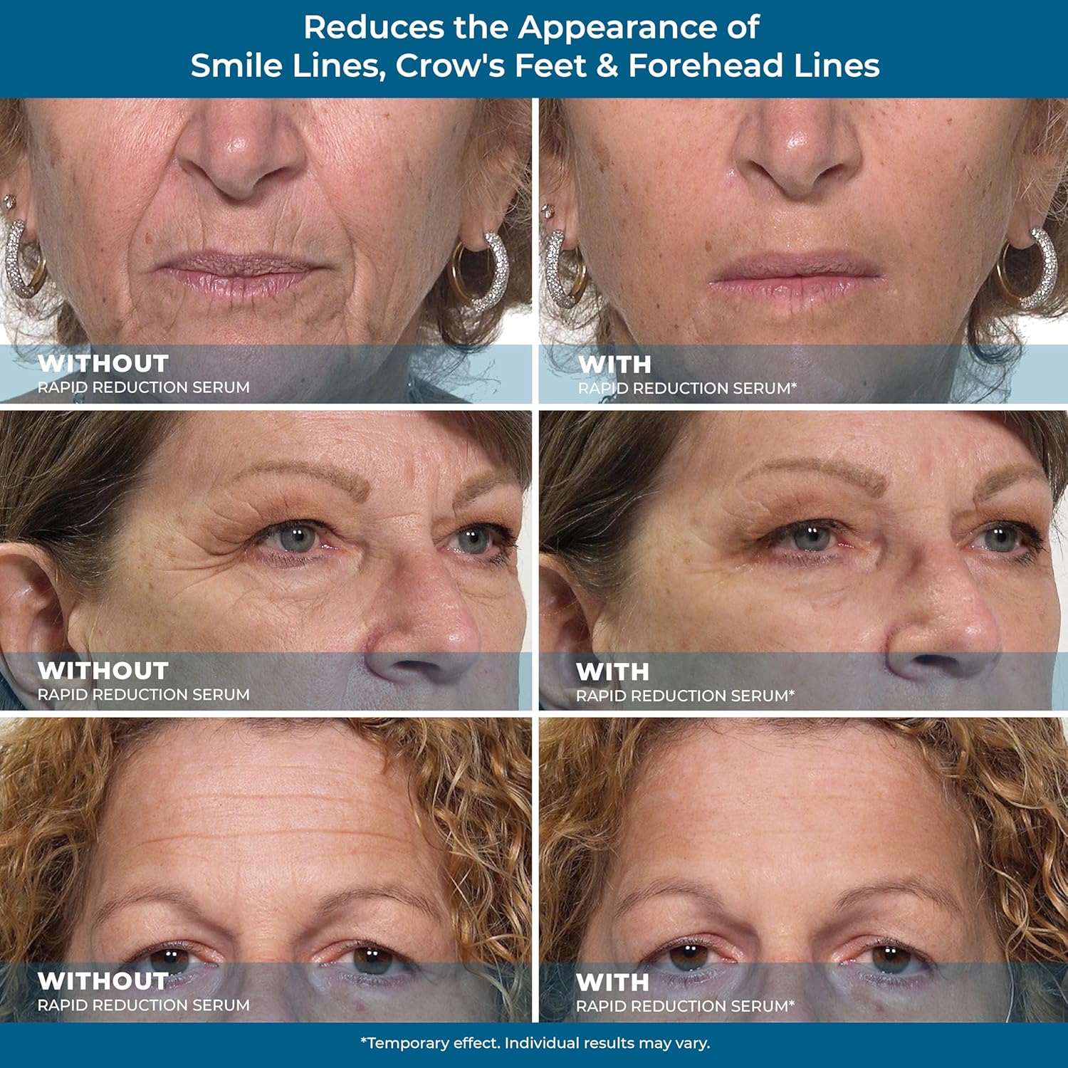 Rapid Reduction Eye Serum I88226