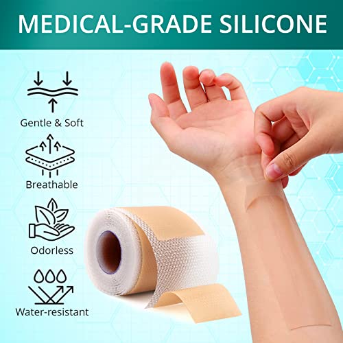 Silicone Scar Sheets, 1.6"x 120" Roll F55941